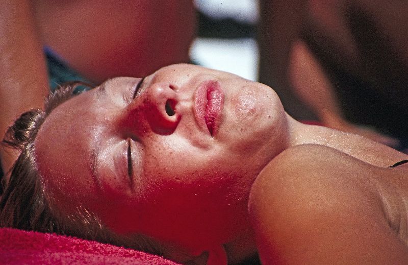 Tipps & Hausmittel bei Sonnenbrand im Gesicht
