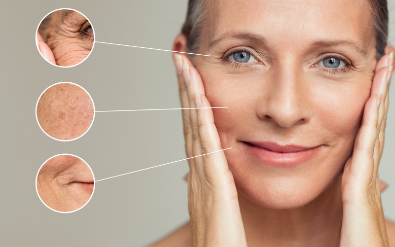Anti-Aging Faltenbehandlung