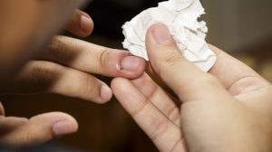 Hausmittel zum Nagelbettentzündung behandeln