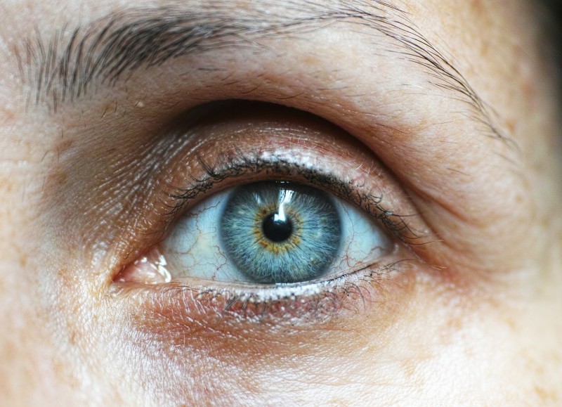 Gestresste Augen