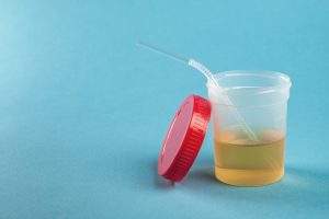 Eigenurintherapie durchführen